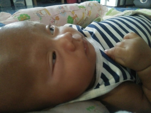 ลูกขอบตาขาว