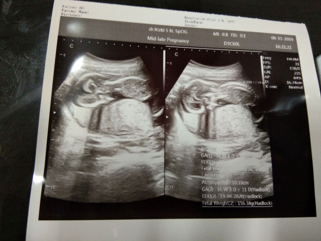 semoga ada mukjizat ?