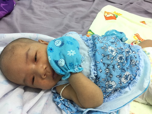 สีผิวลูก