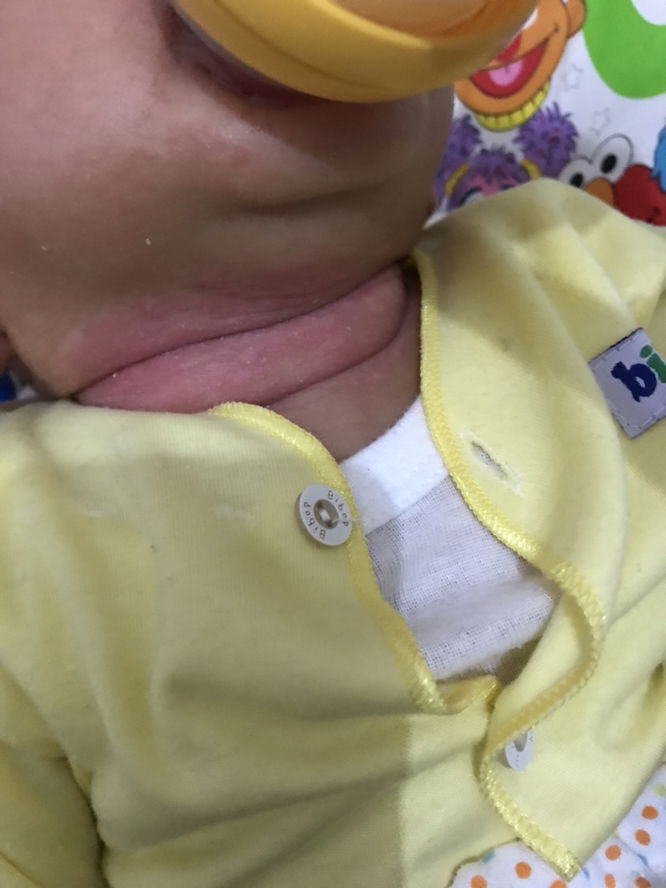 Kulit kering dan merah