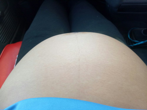 29w6d