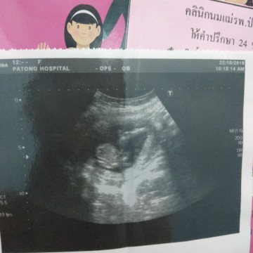 15wแล้วตื่นเต้นเป็นอย่างมาก?