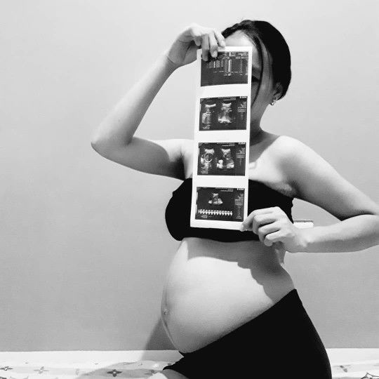 Shereenkeem Pateña profile icon