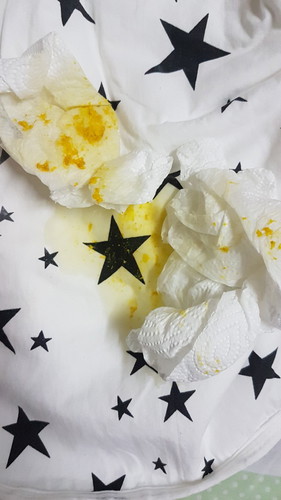 อุจจาระเป็นน้ำปนเนื้อ