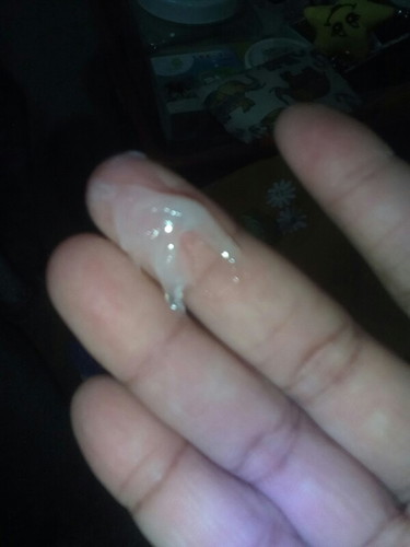 ใครก็ได้ช่วยบอกทีนิมันคือตกขาวหรือมูลมสๆๆ