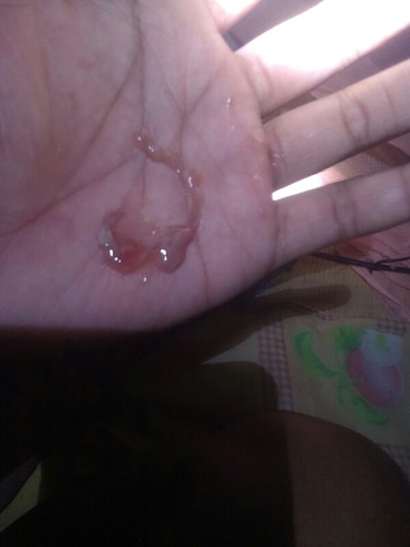 มีมูกสีน้ำตาลมันจะอันตรายไหมค่ะ