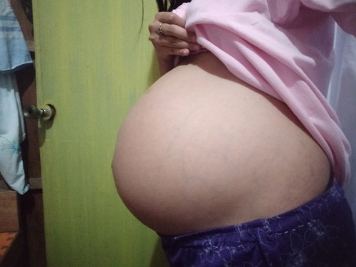 35weeks.