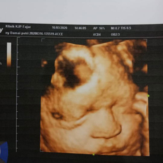 Damai Putri Dewi profile icon