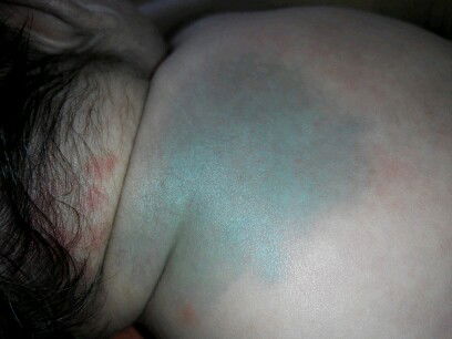 tanda lahir atw bukan?