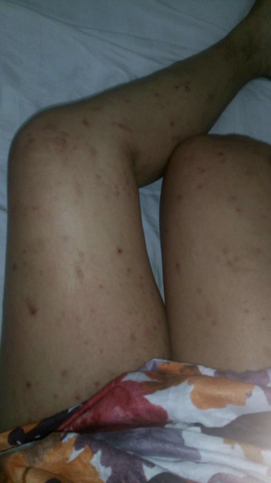 puppp  daw po yan na research ko na den