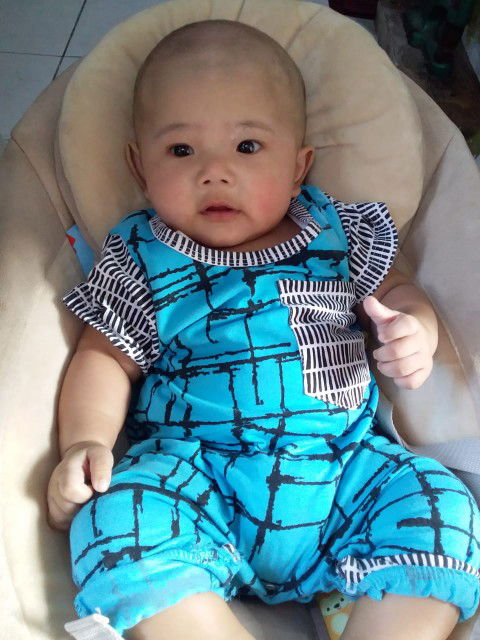 bayi di gundul