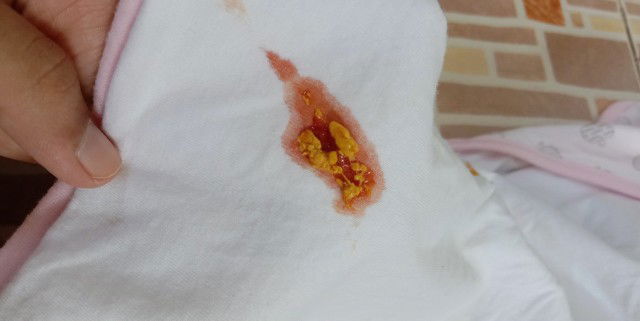 กังวลมากเลยค่ะ