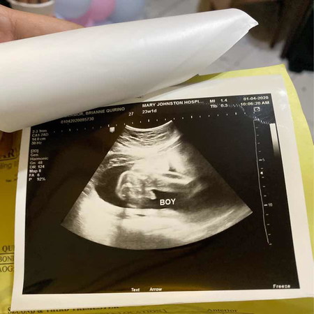 It's a Baby BOY!!