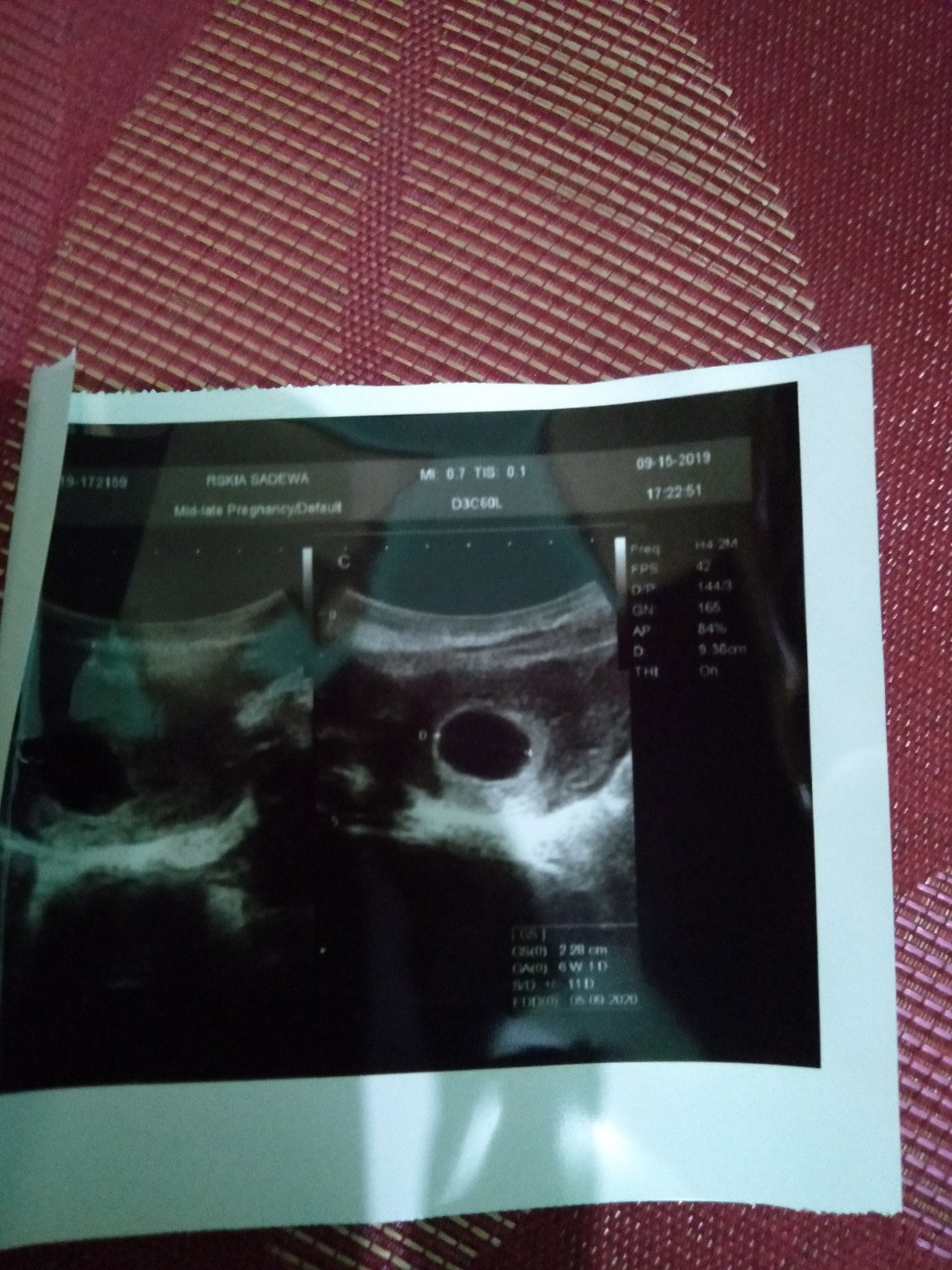 9 week