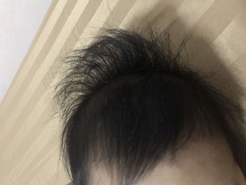 เส้นผมลูก (ผมช็อต)?