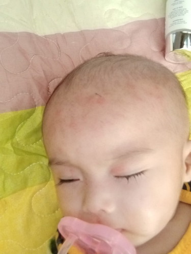 merah Gatal2