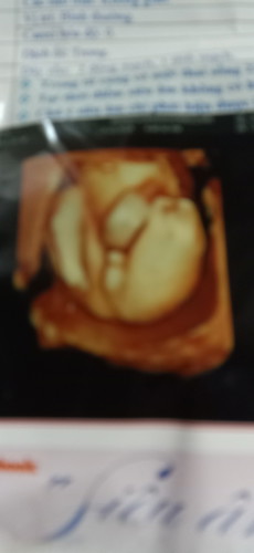 bác Sĩ chụp hình cho bá đạo nhất