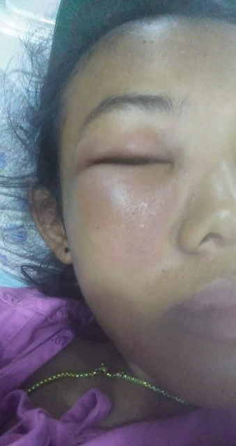 ตั้งครรภ์​