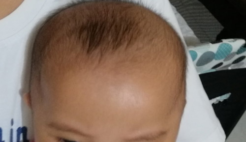 Shape Of Front Head