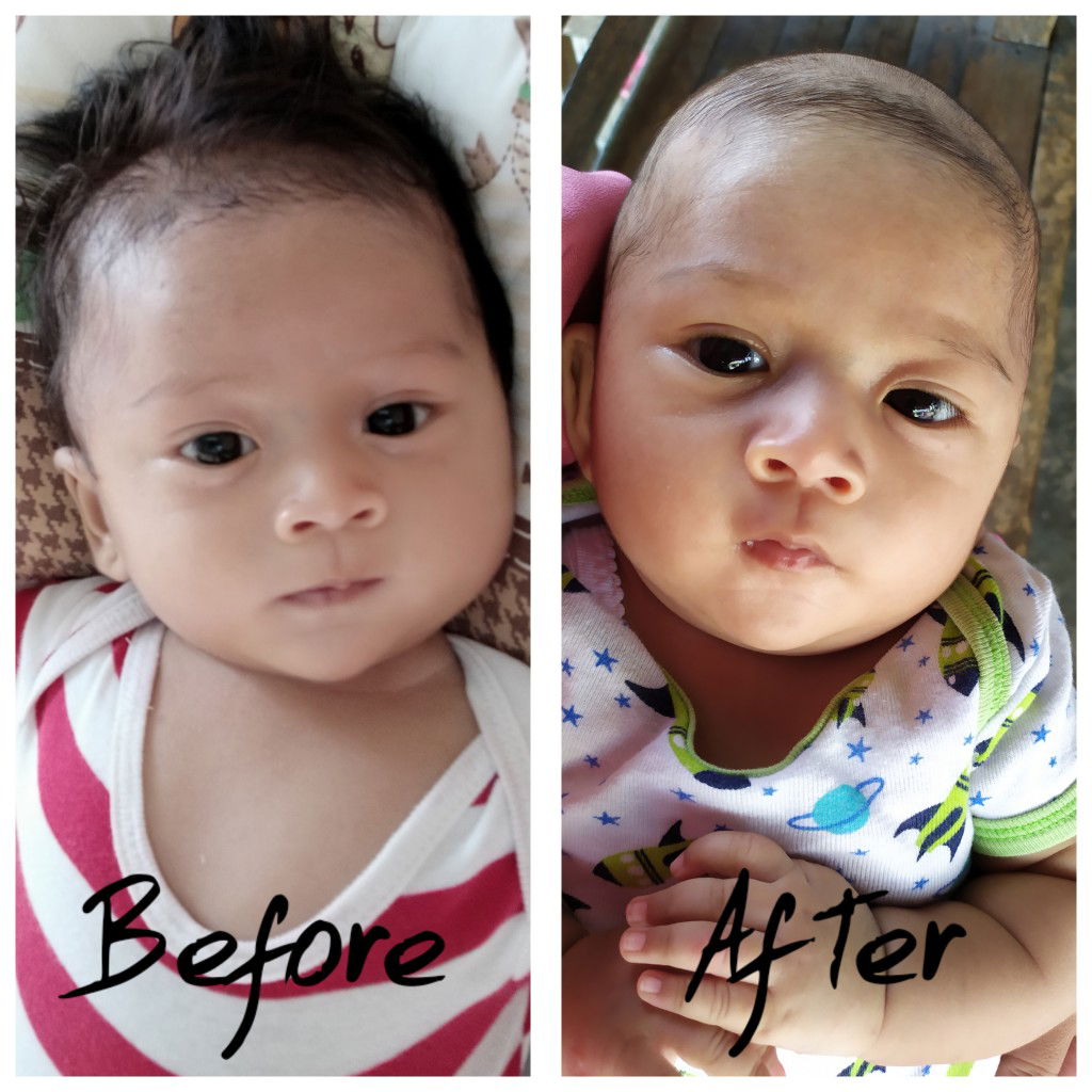 SETUJU BAYI DIGUNDULI ATAU TIDAK ?