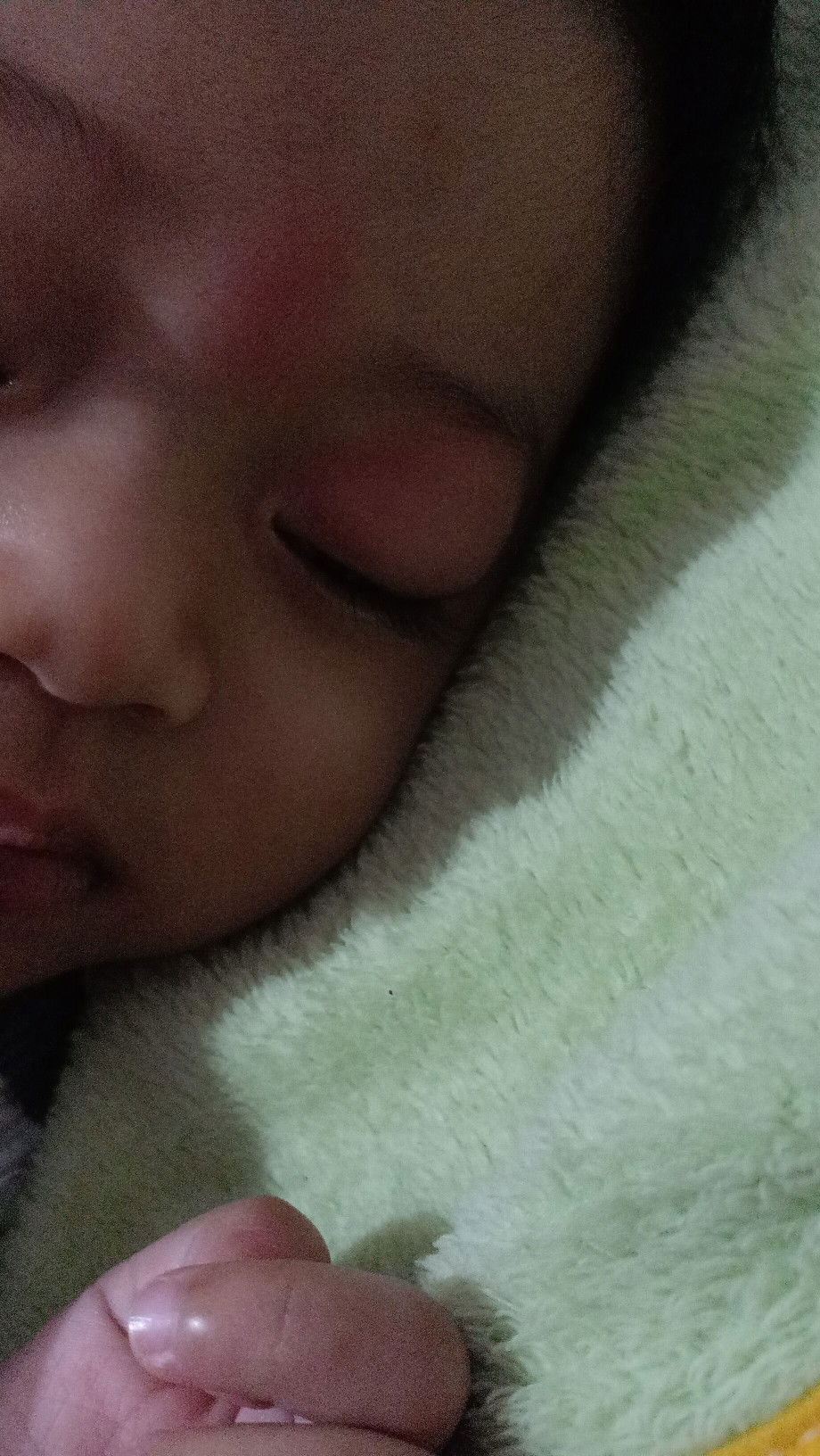 mata bengkak ketika bangun tidur