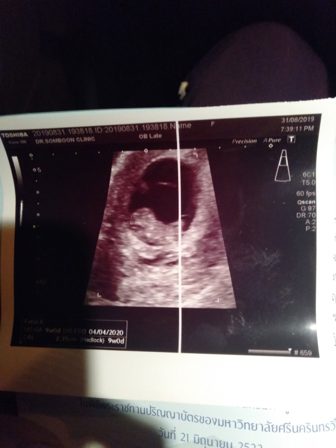 ขอสอบถามแม่ๆหน่อยค่ะ