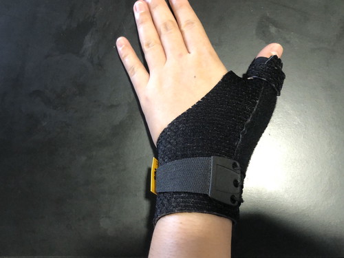 คุณแม่ท่านไหนเป็นโรคเดอกาแวงหรือเอ็นข้อมืออักเสบบ้างคะ