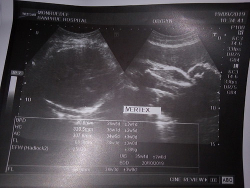 ลูก