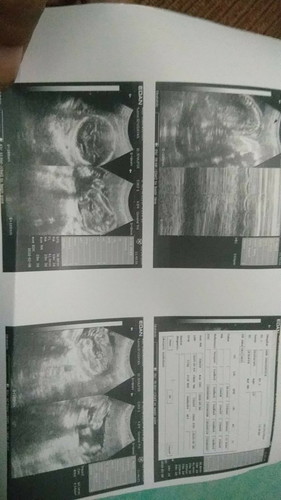 ultrasound