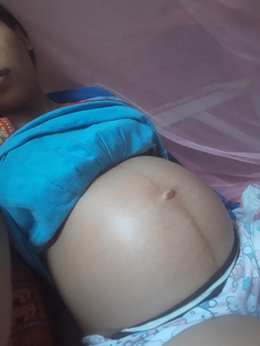 ท้องเล็ก