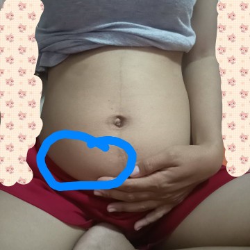 ลูกดิ้นข้างเดียว