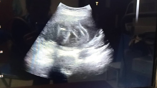 เพศลูก