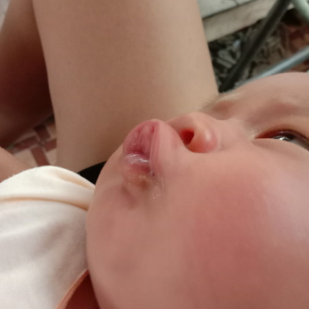 เห่อลูก