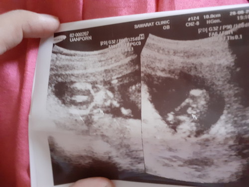 ญ หรือ ช คะ