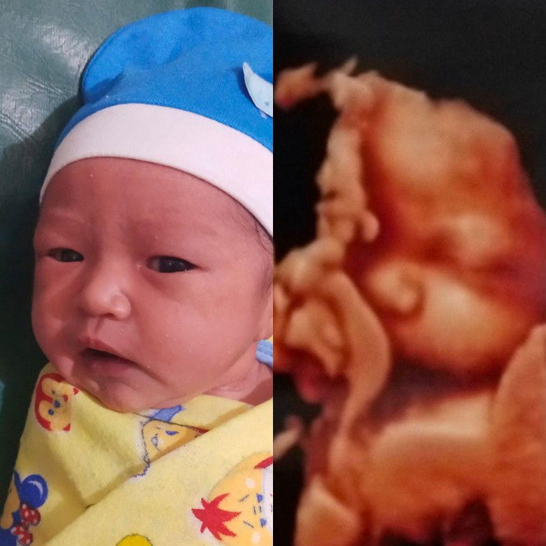 alhamdulillah tepat 40 weeks