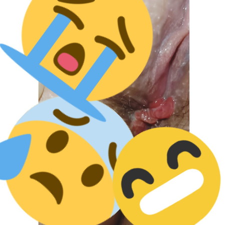 FLESH BELOW VAGINA
