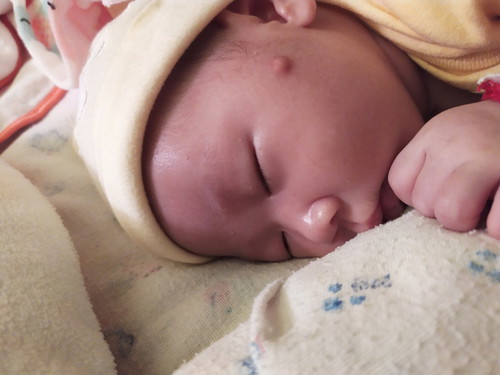 โดนยุงกัดเป็นตุ่มไตแข็ง