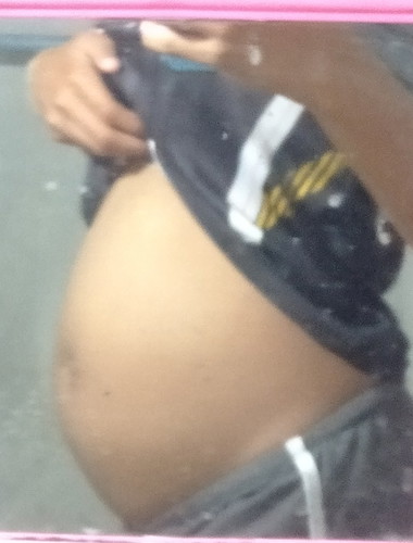 ท้องเล็กไปมั้ย??