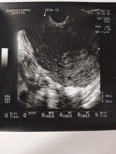 ถามแม่ๆหน่อยค่ะ ว่าแบบนี้น้องยังอยู่หรือป่าว กังวลใจและทำตัวไม่ถูก