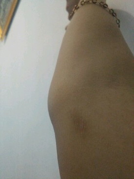 gatal saat hamil