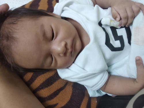 แม่ๆบ้านไหนลูกขึ้นผื่นบนใบหน้ากันบ้างคะ ใช้อะไรถึงจะหายบ้านนี้ลูกขึ้นผื่นแดงๆเต็มหน้าเลย