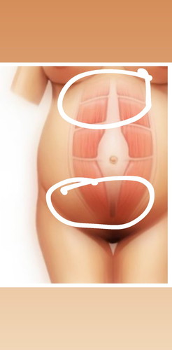 ปวดท้อง + ท้องเสีย