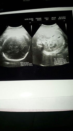 33week