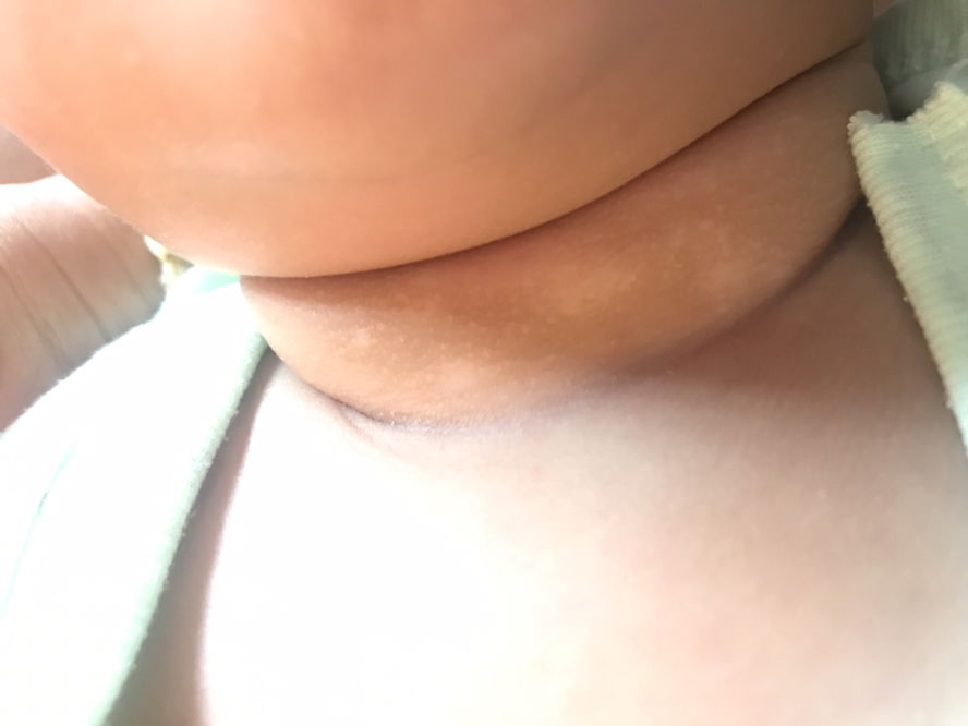 คอของลูก