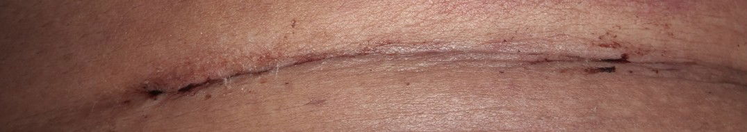 czer mmg pedih ke kt blh hujung²