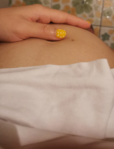 ทานนมแล้วท้องอืด