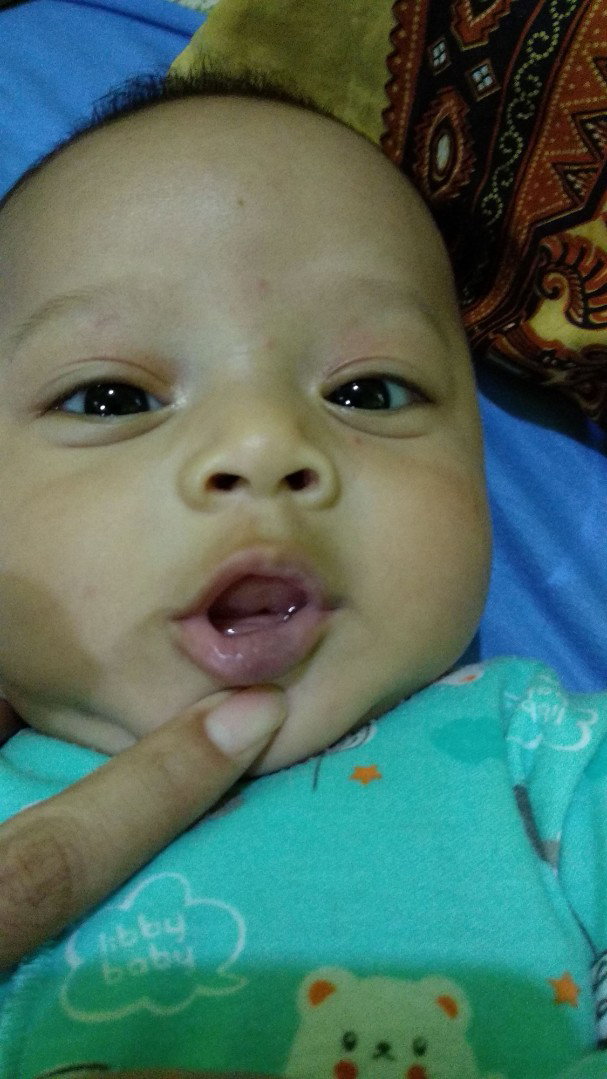 bibir bayi gelap membiru