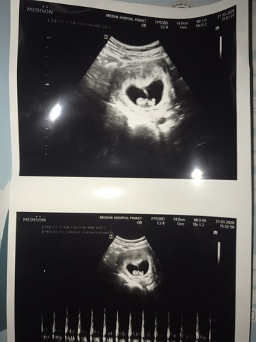 ซาวด์ 8W6D (คุณแม่ เป็นมะเร็งไทรอยด์ แต่รักษา จนหาย แล้ว )