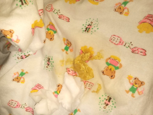 ท้องเสียไหม