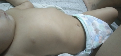 chest